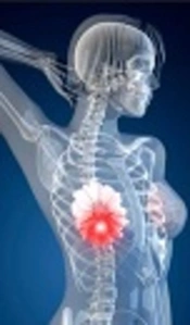 CYP1A1 Gene Polymorphism and Breast Cancer